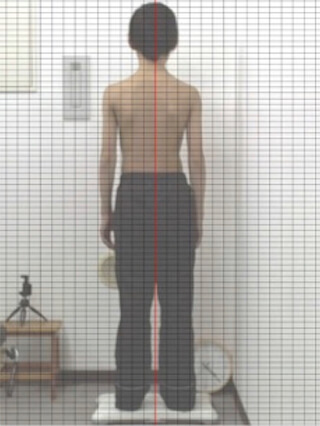 オスグット12歳男の子 調整直後